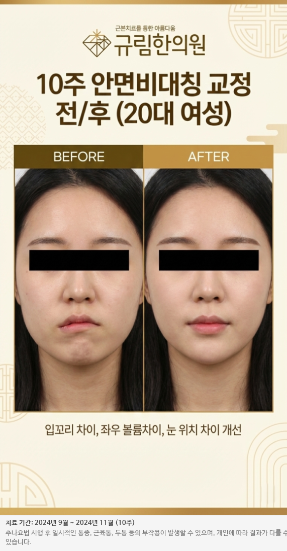 체형 교정 전후