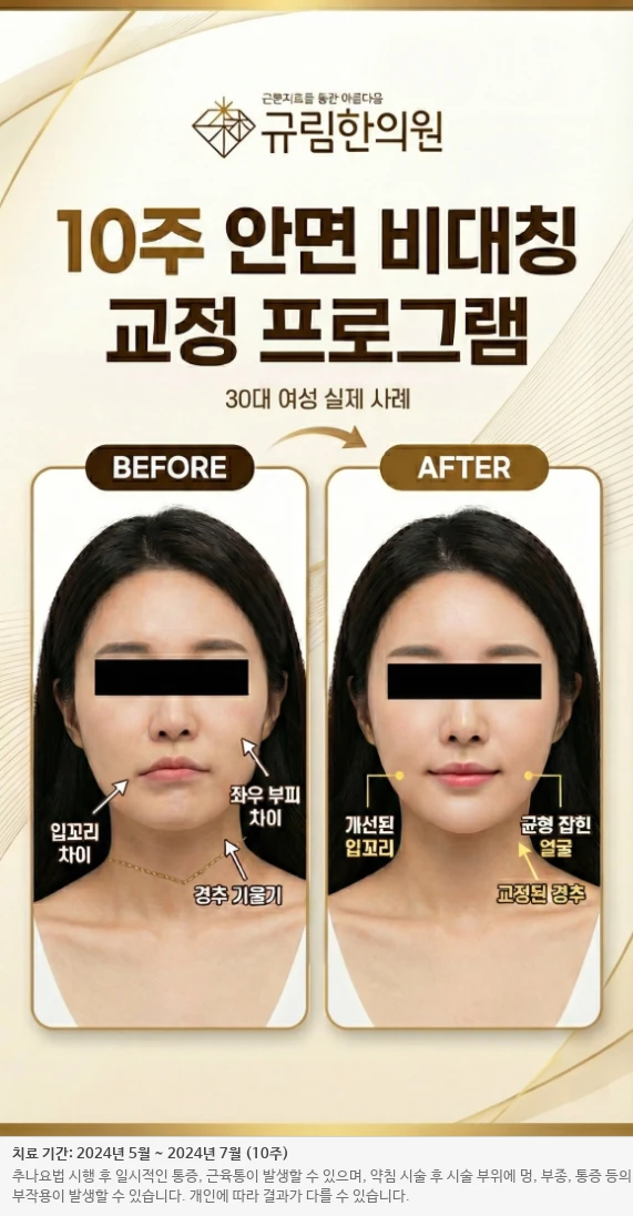 거북목 라운드숄더 교정 전후