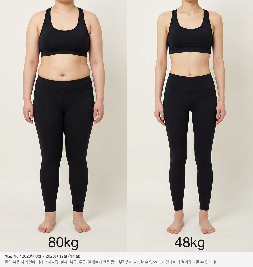 전신 감량 전후